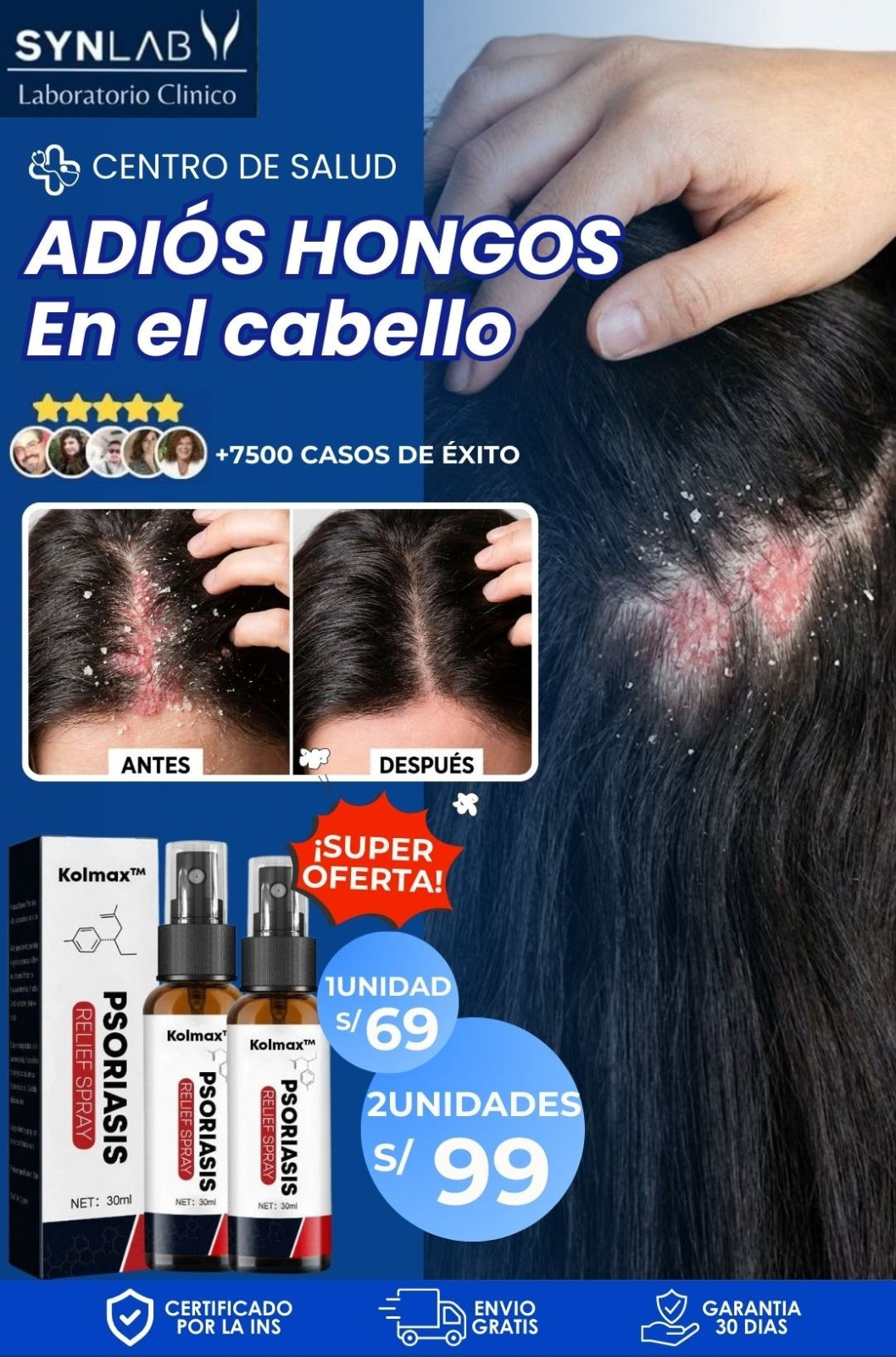 Spray Psoriasis® TRATAMIENTO ANTICASPA |Elimina la Dermatitis Seborreica
